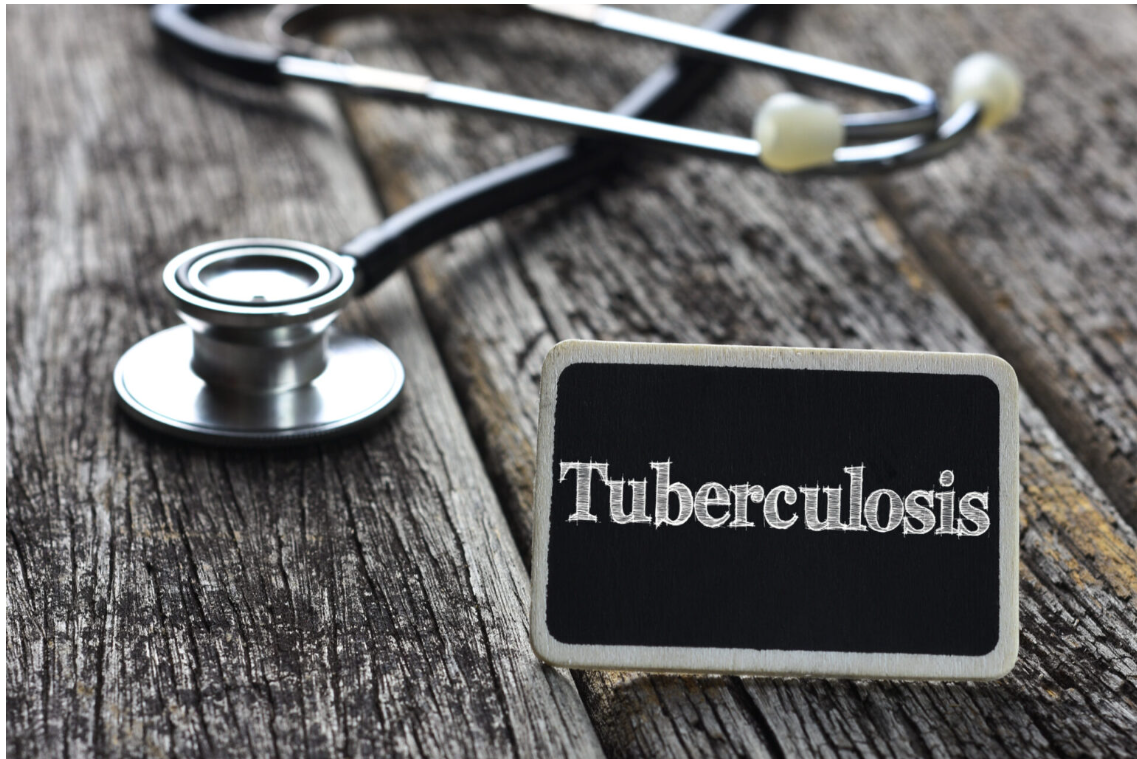 TUBERCULOSIS