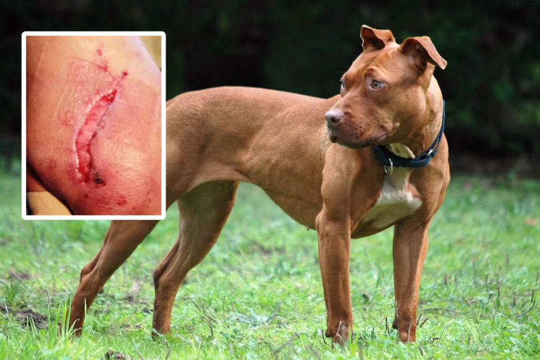 Perro ataca a varias personas entre ellos un menor en Natura