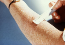 Alertan por posible exposición a tuberculosis en preparatoria de San Diego